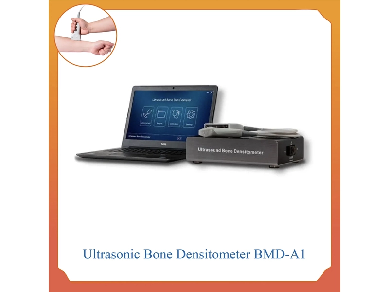 Ultrasonic Bone Densitometer Kit Precise Measurement of Bone Density
